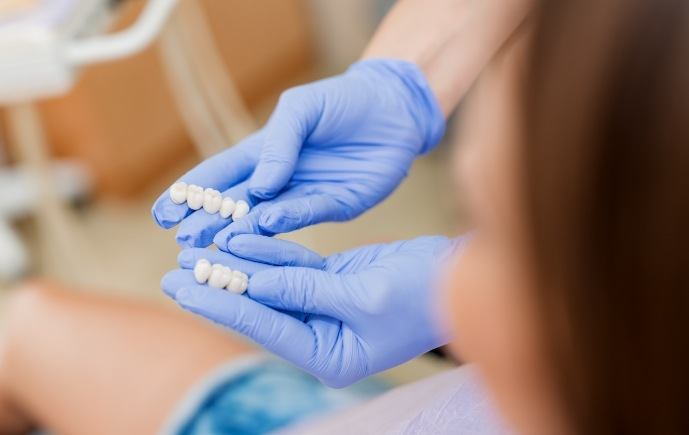 Dentist showing dental bridges to dental patient