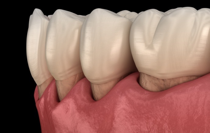 Animated smile with gum disease warning sign receding gums