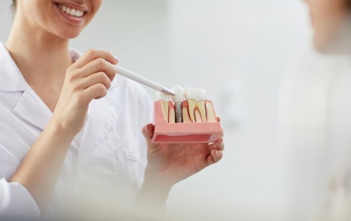 Dentist and patient discussing the four step dental implant process